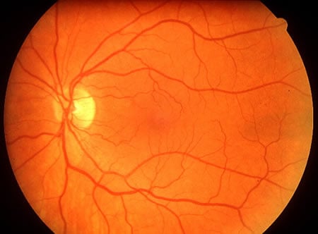 Olhos podem indicar presença de riscos para a saúde cardiovascular